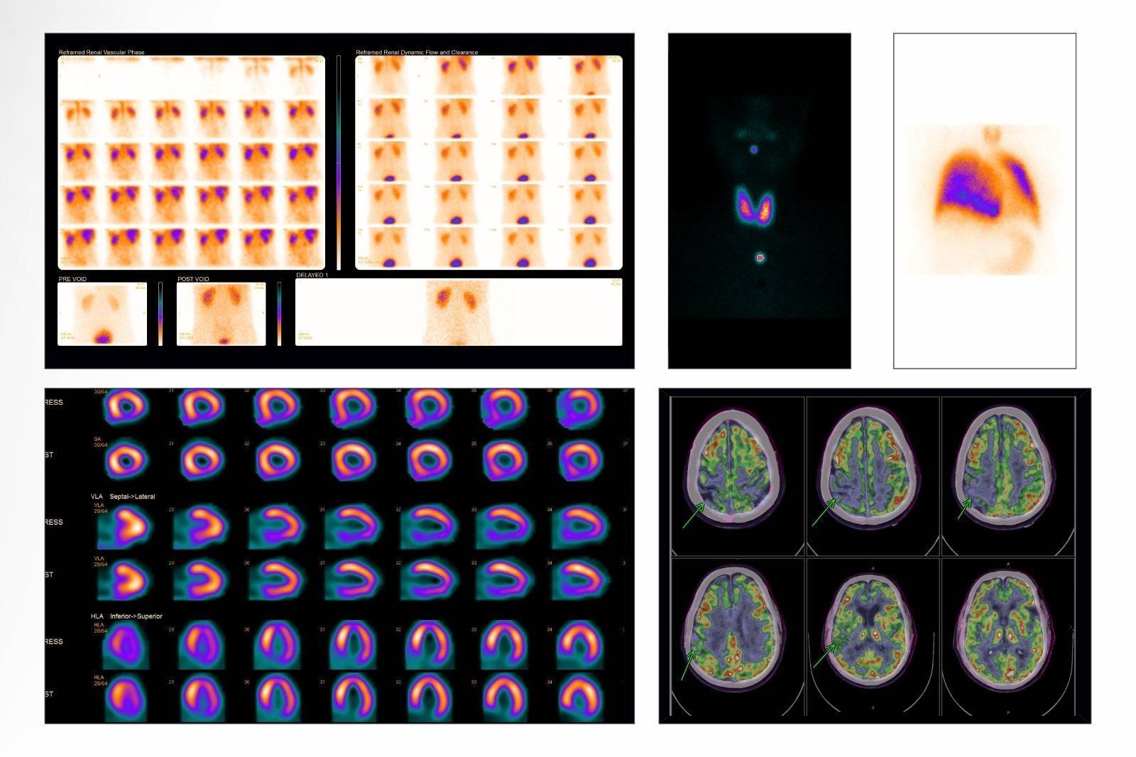 CT Scan Near Me In Rohtak