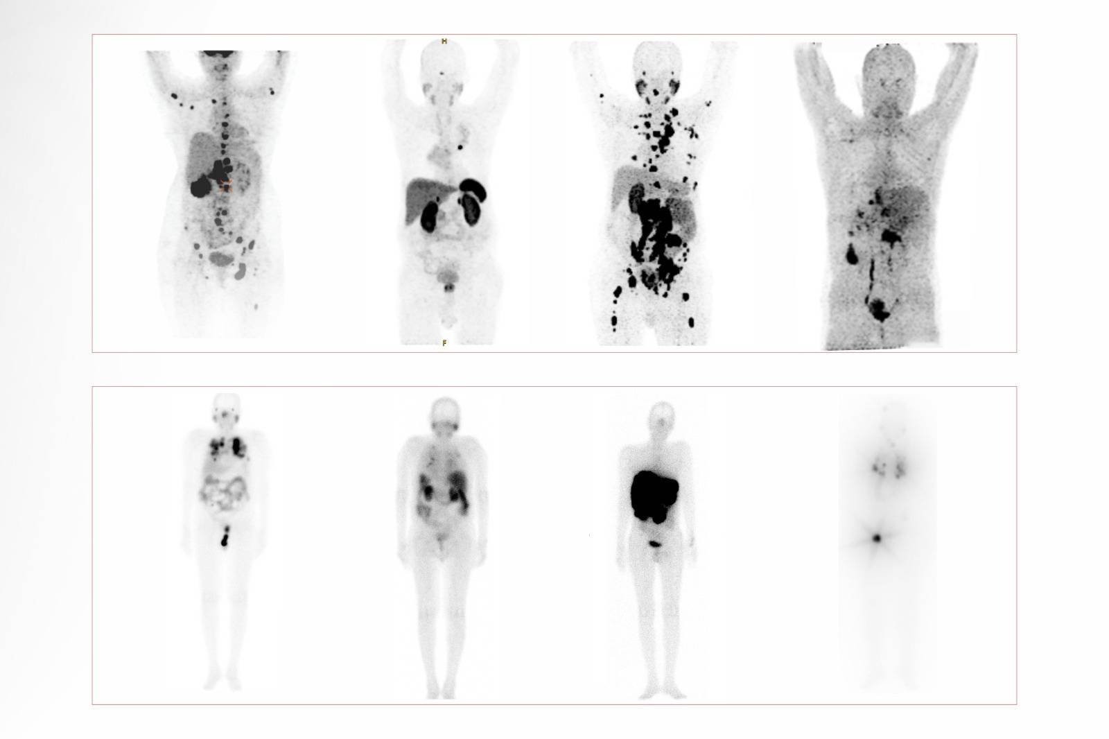 CT Scan Near Me In Rohtak