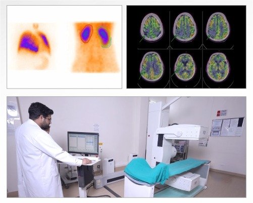 Gamma Camera Scan in Rohtak