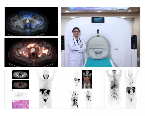 PET CT Scan in Rohtak