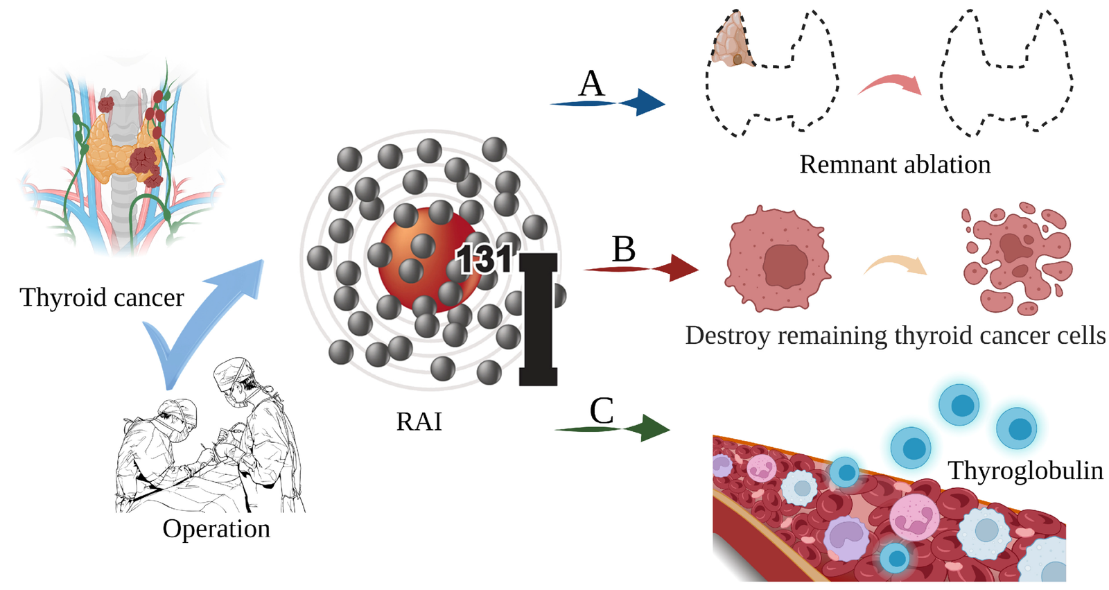 Thyroid Cancer and I-131 Therapy: Myths, Preparation, and Post-Treatment Care